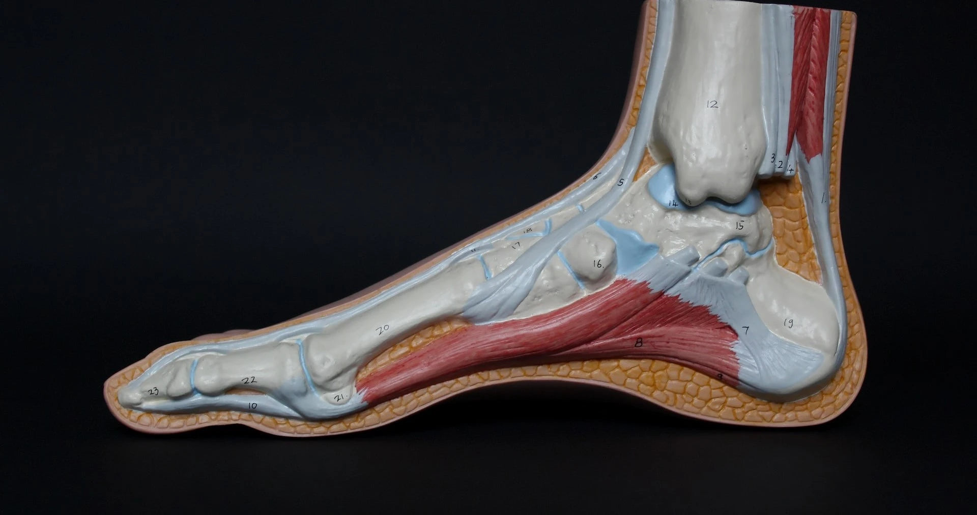 5 Best Shoes for Metatarsalgia SASNola